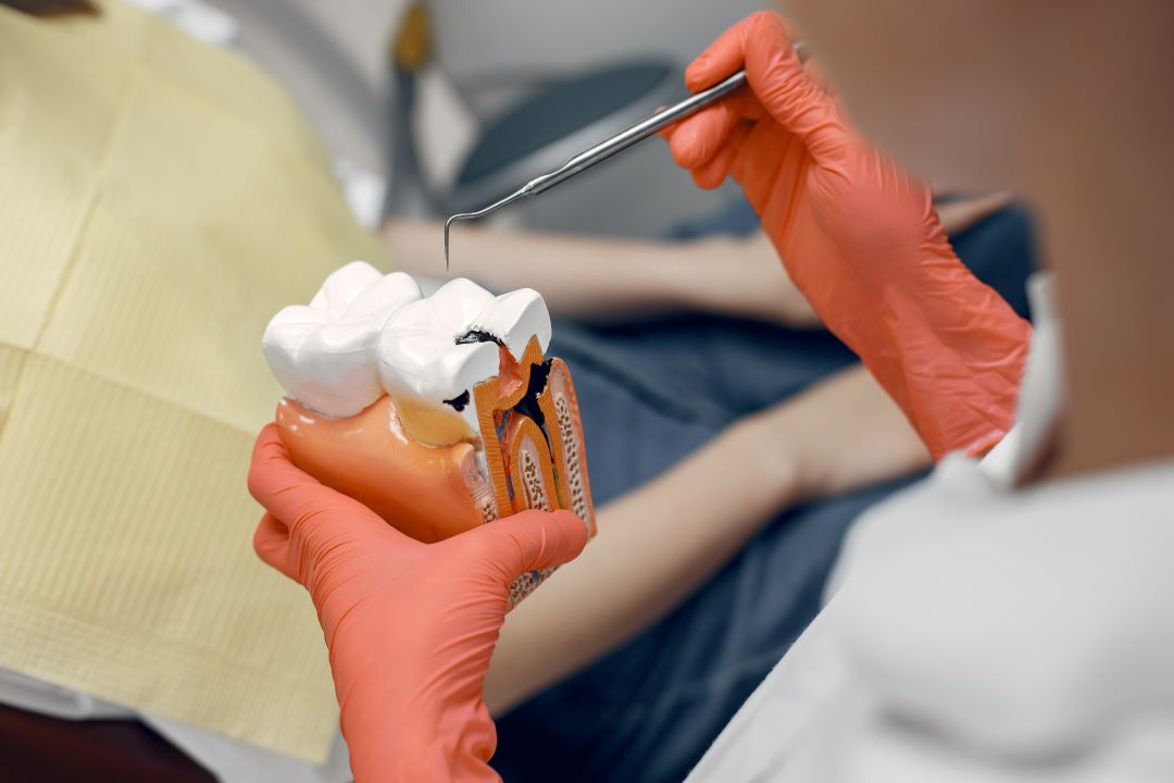 our dentist explaining about dental fillings