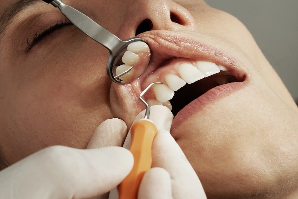 patient taking dental cleaning treatment at our dental clinic