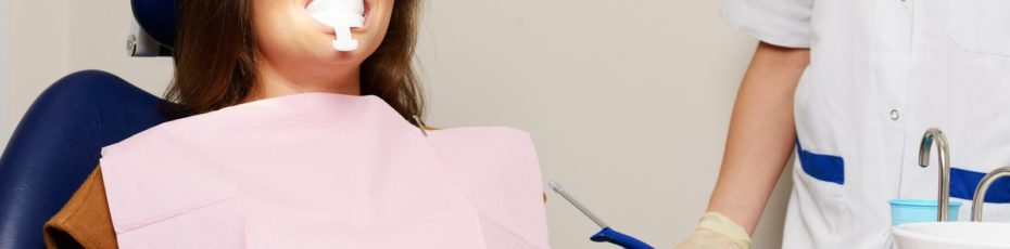 why to ask a dentist to whiten your teeth