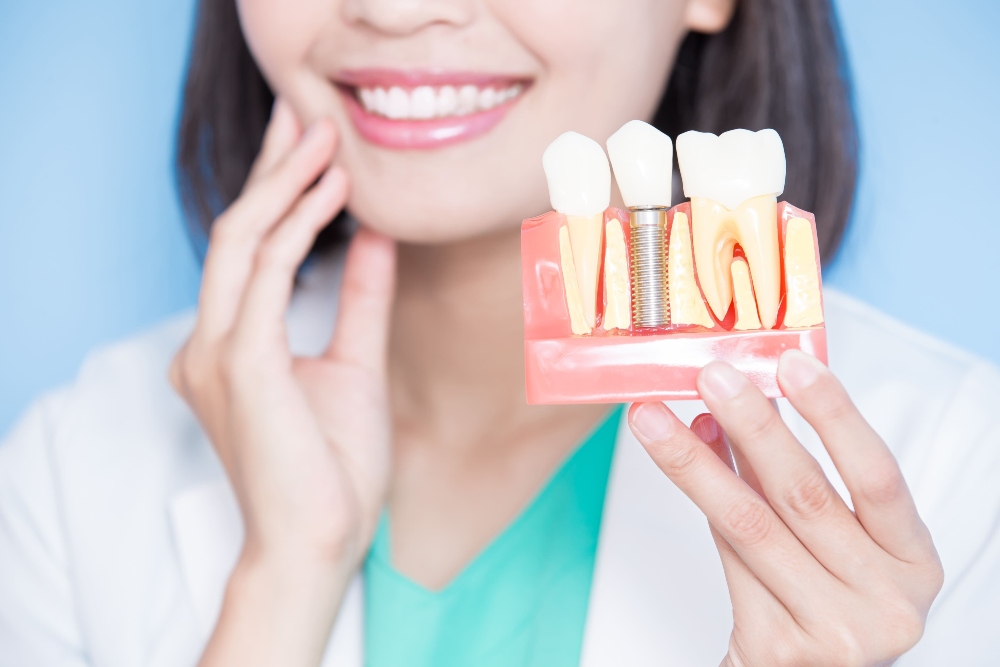 Is Getting Dental Implants Worth It?