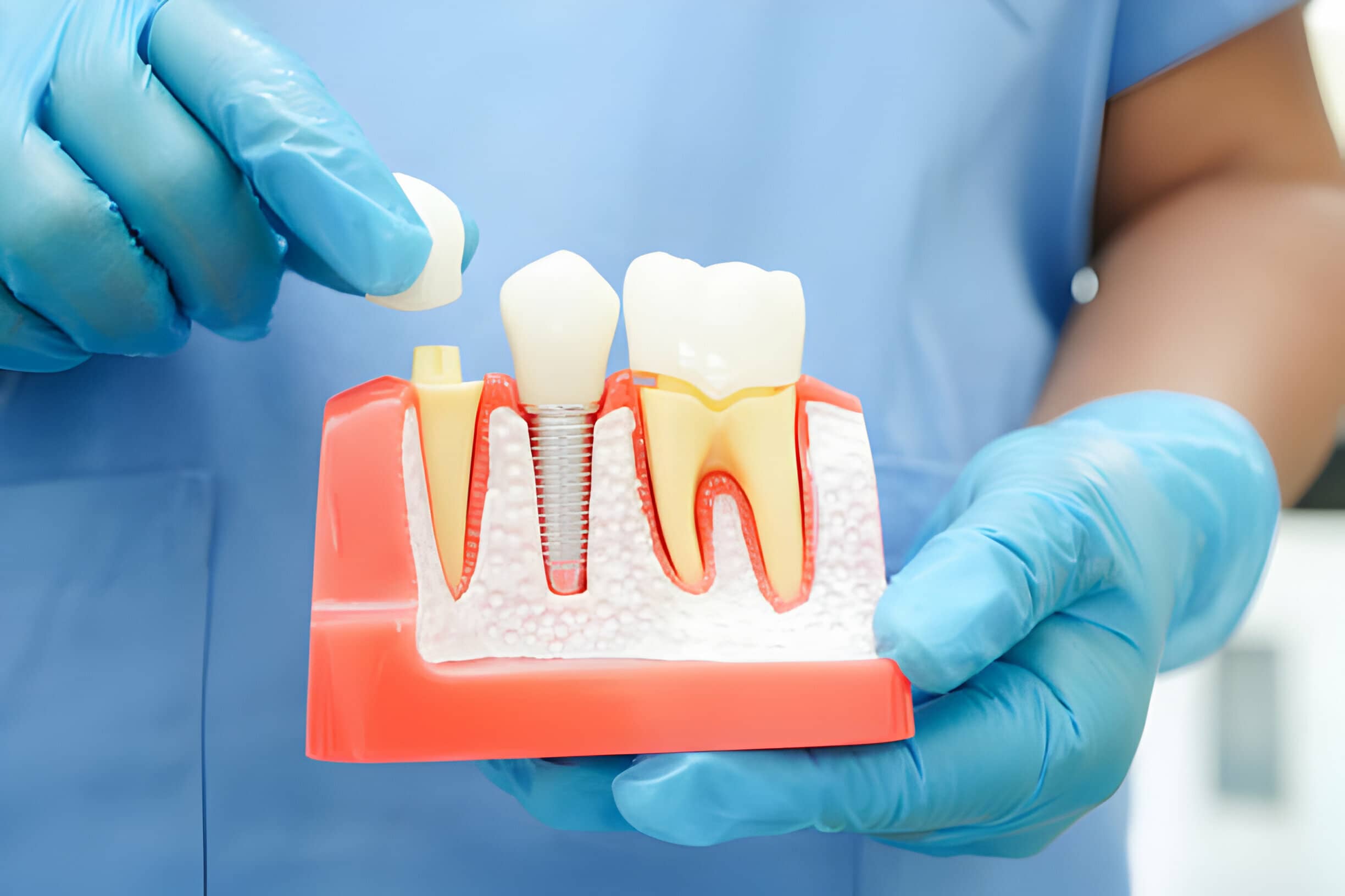 How Dental Implants Can Transform Your Confidence