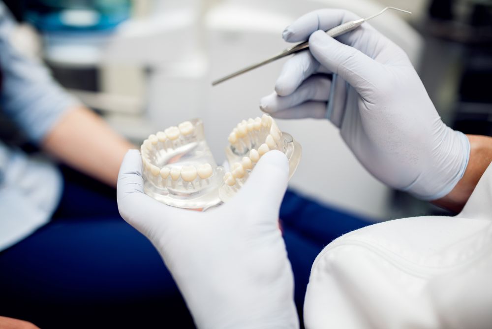 dental implants