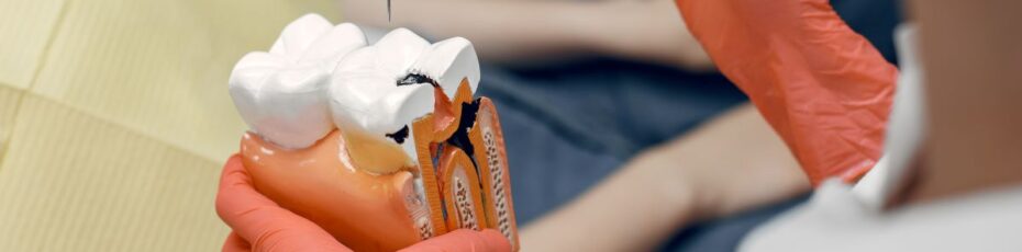 root canal therapy in dearborn