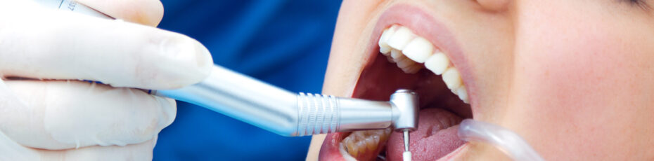 Dental Cleanings
